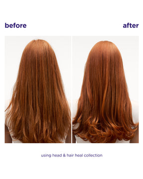 Before and after comparison of long, straight auburn hair on a person's head, showing hair health improvement. The text reads 'before', 'after', and 'using head & hair heal collection'.
