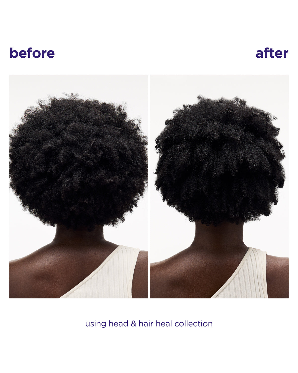 Before and after comparison of a person's dark curly hair, showing a fuller, healthier hair texture on the right. The text reads 'before', 'after', and 'using head & hair heal collection'.